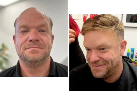 How to Choose the Right Hair Wig Glue for a Secure and Comfortable Fit